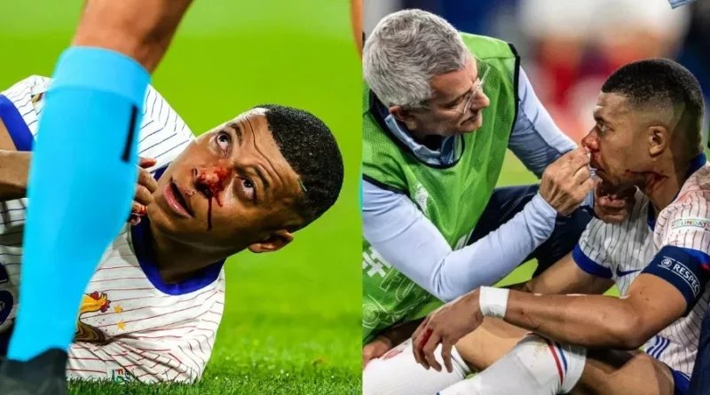 Kylian Mbappe Injury