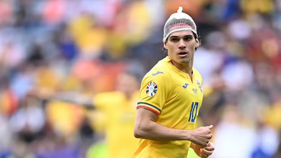 Why did Ianis Hagi wear a hair net in Romania&#8217;s defeat to Netherlands?