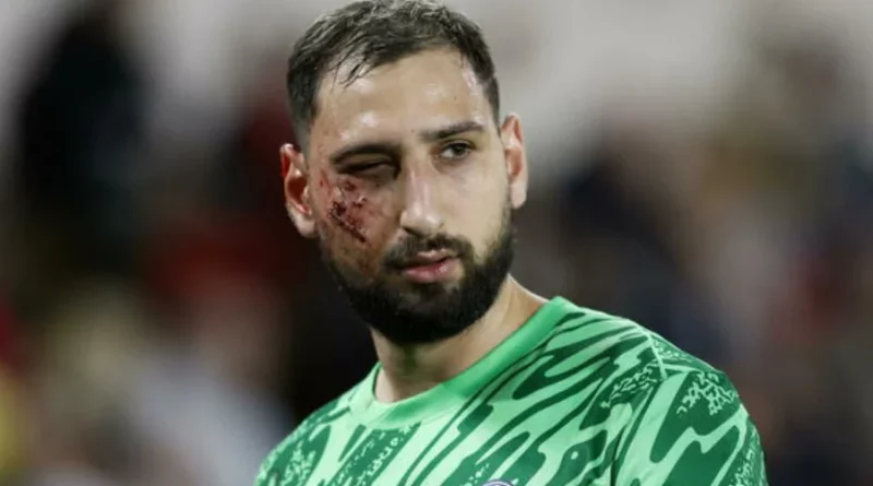 Gianluigi Donnarumma Injury Update